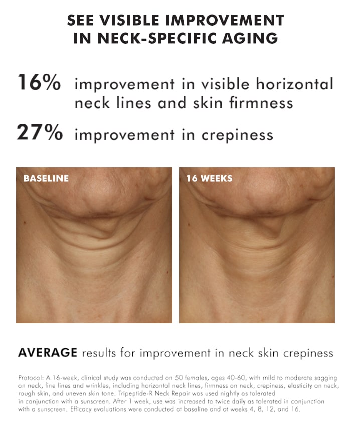 Project Skin MD Vancouver_Tripeptide-R_Neck_Repair_4