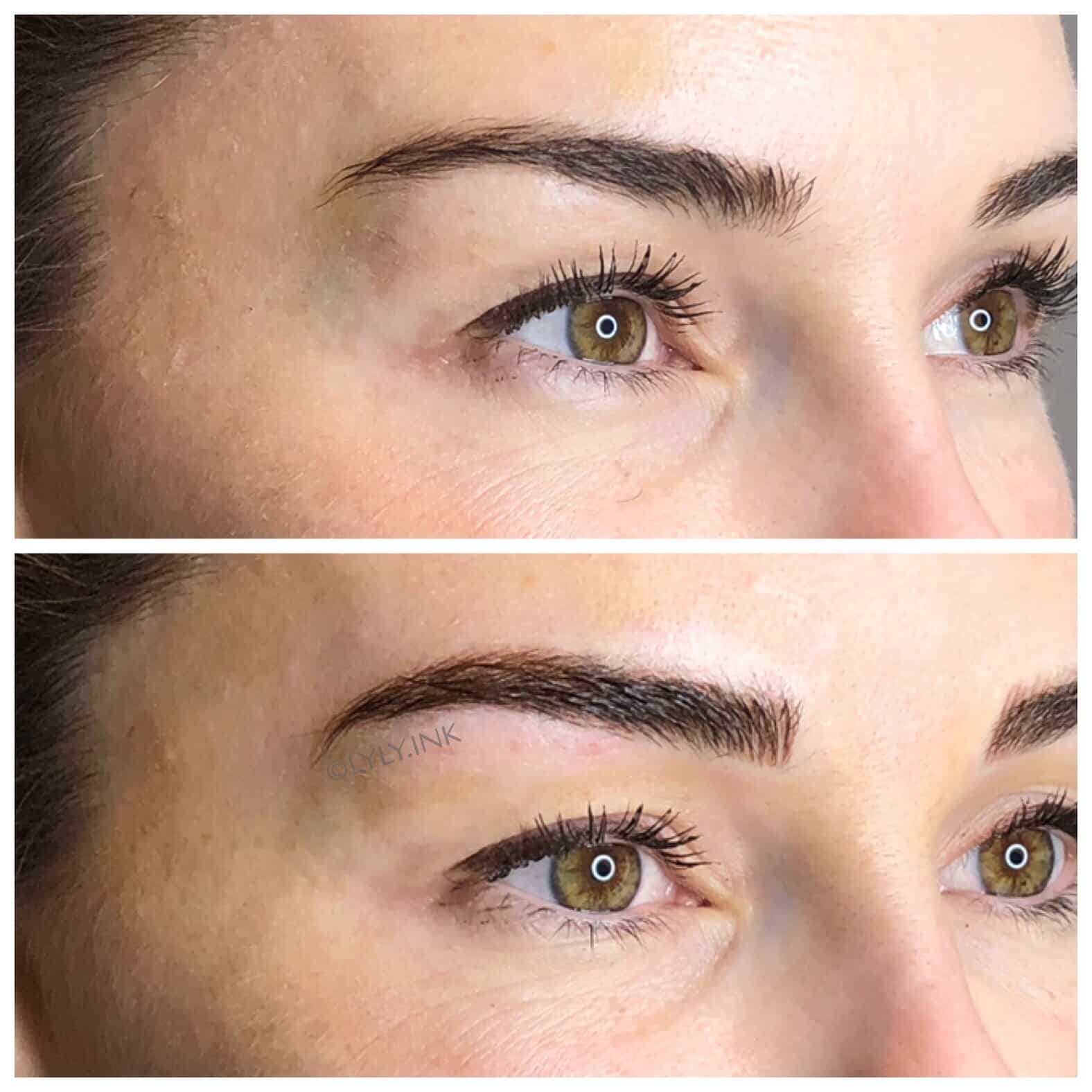 Project Skin MD Vancouver_Vanessa_Microblading_B&A