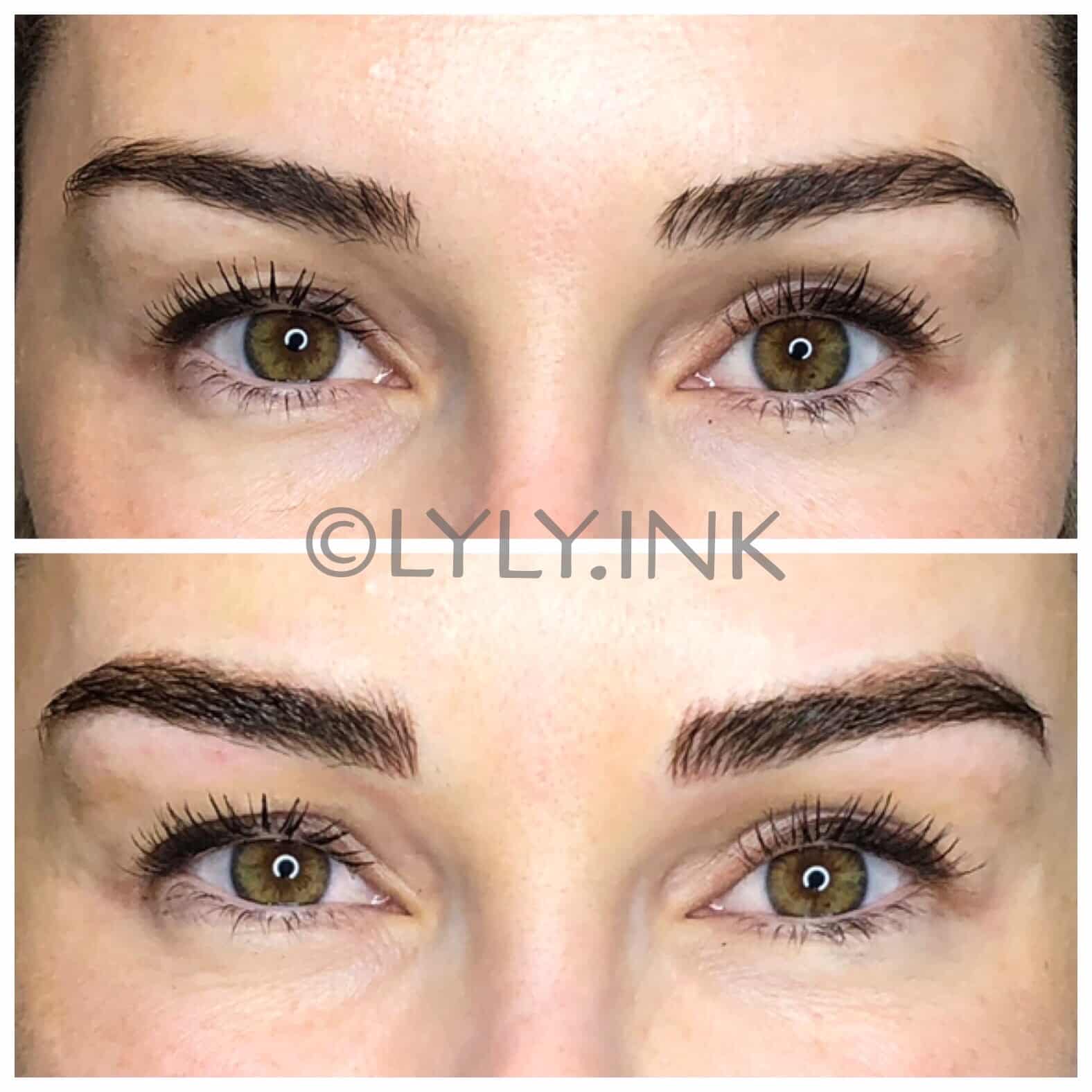Project Skin MD Vancouver_Vanessa_Microblading_B&A_2