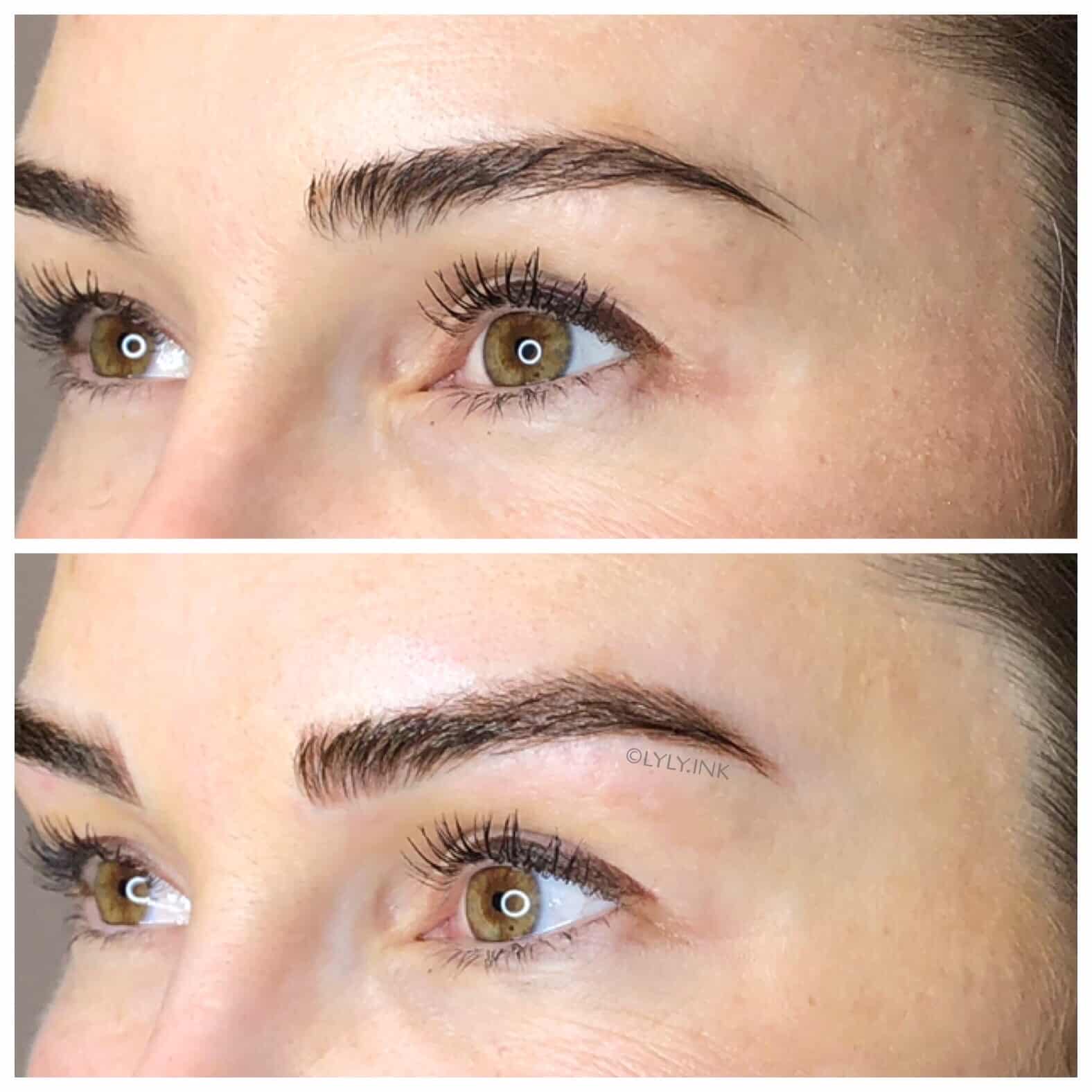 Project Skin MD Vancouver_Vanessa_Microblading_B&A_3