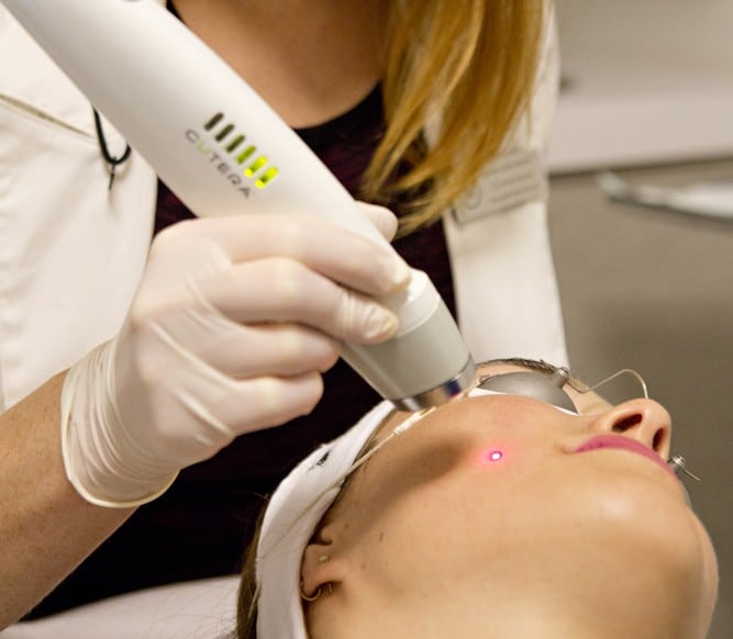 Project Skin Vancouver Laser Genesis Facial 3