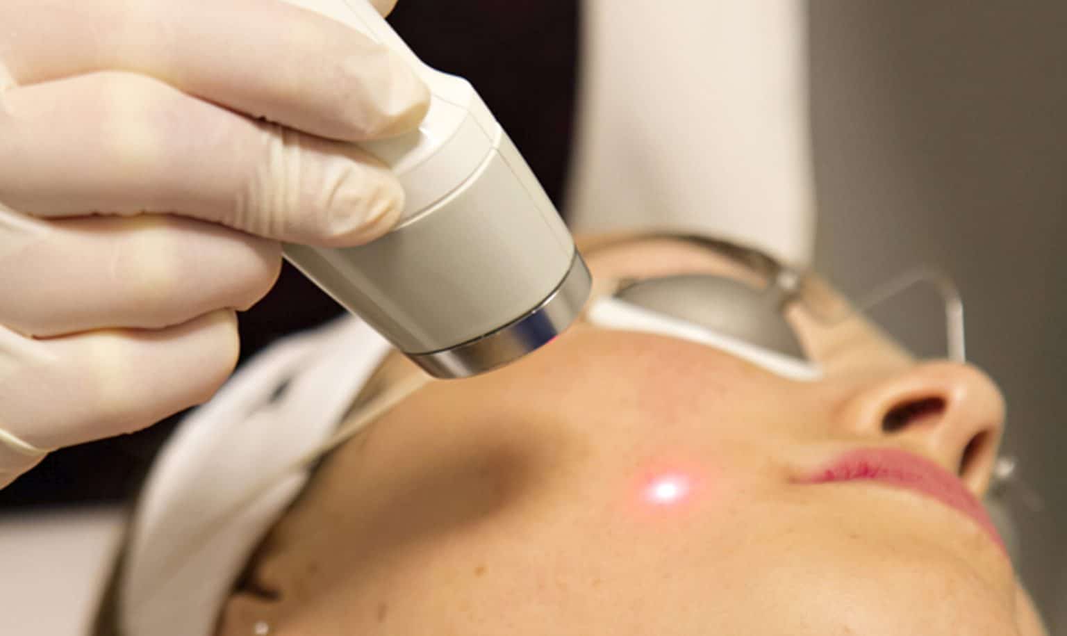 Laser Genesis Project Skin MD®