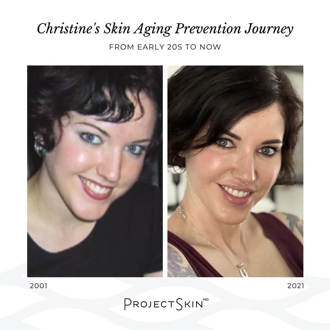 Project Skin MD Christine Palylyk