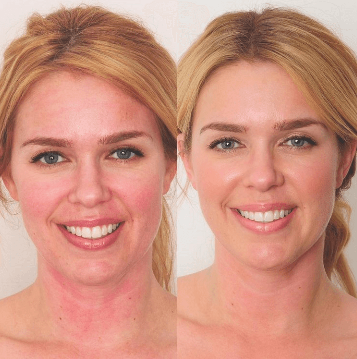 Bend Beauty Renew + Protect Before and After