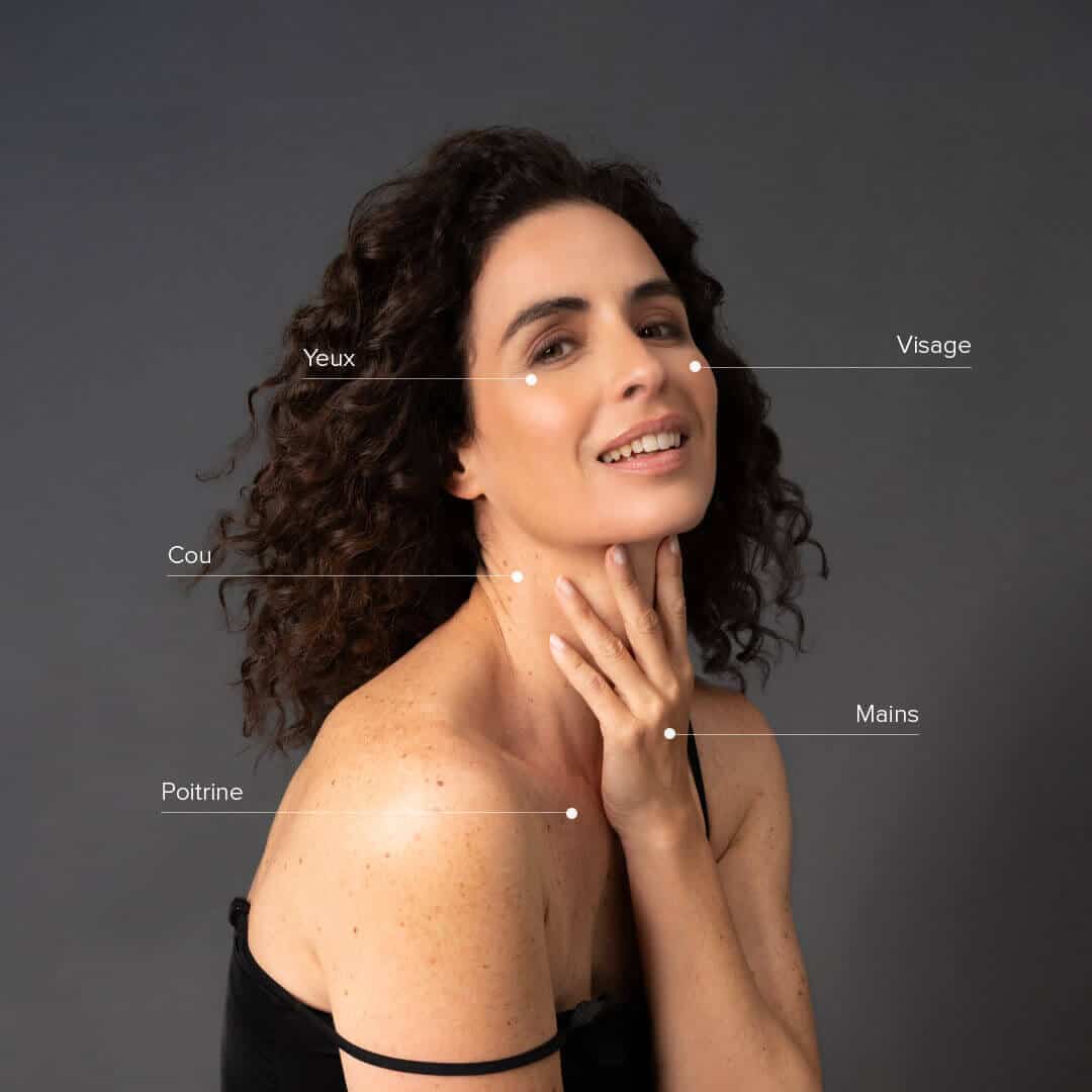 ClearLift_treatable_areas_woman_FR